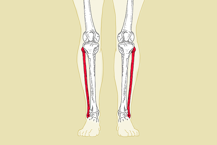 Fibula bone runs parallel with the tibia and connect the knee with the ankle